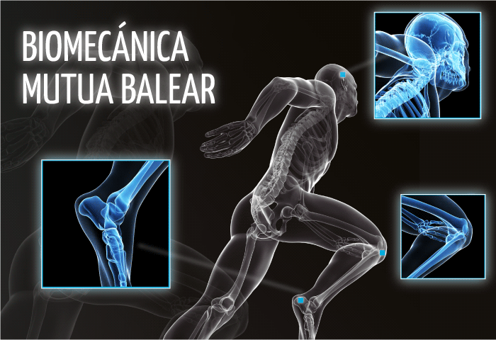 Biomecánica en Mutua Balear