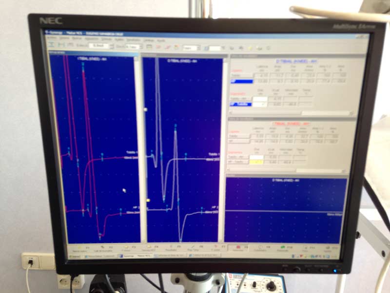 CONSULTA DE ELECTROMIOGRAFÍA