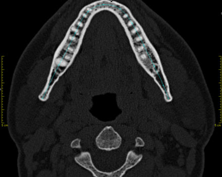 TAC DENTAL